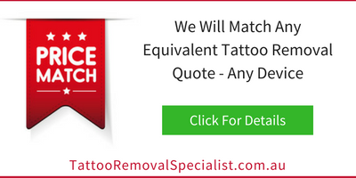 painless laser tattoo removal does it exist painless laser tattoo removal does it exist