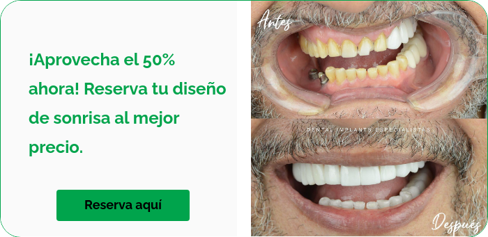   ¡Aprovecha el 50% ahora! Reserva tu diseño de sonrisa al mejor precio.     