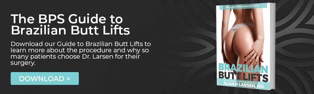 Brazilian Butt Lifts Guide