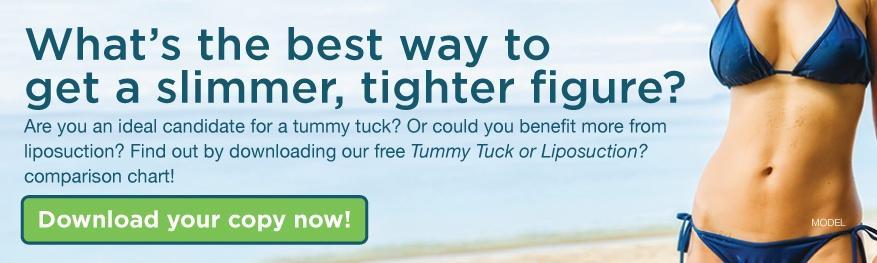 tummy-tuck-or-lipo