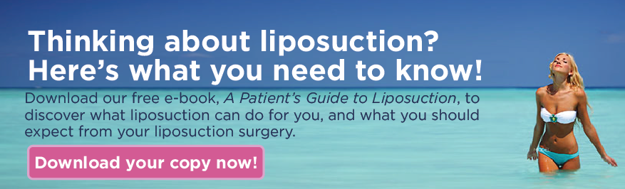 Thinking about liposuction?